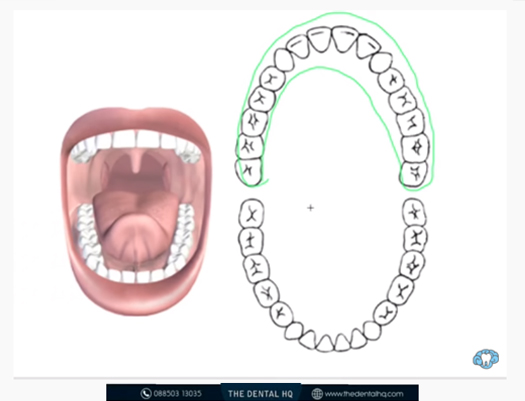 Why is a Root Canal Treatment needed?