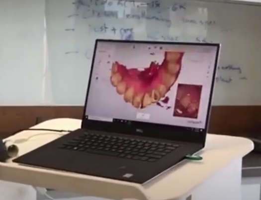 Digital dentistry using 3D scanner at The Dental HQ